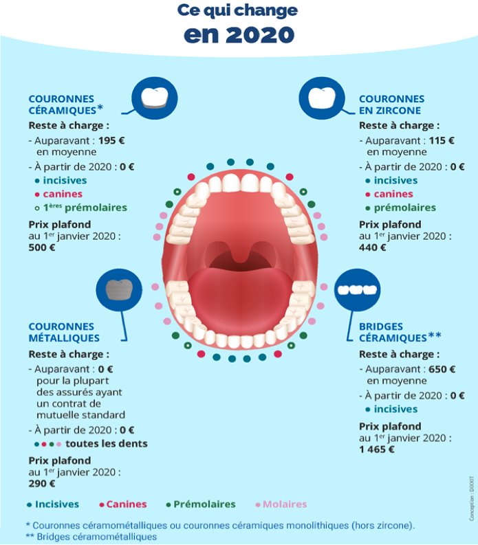 ce qui change en 2020 sur les remboursements dentaire