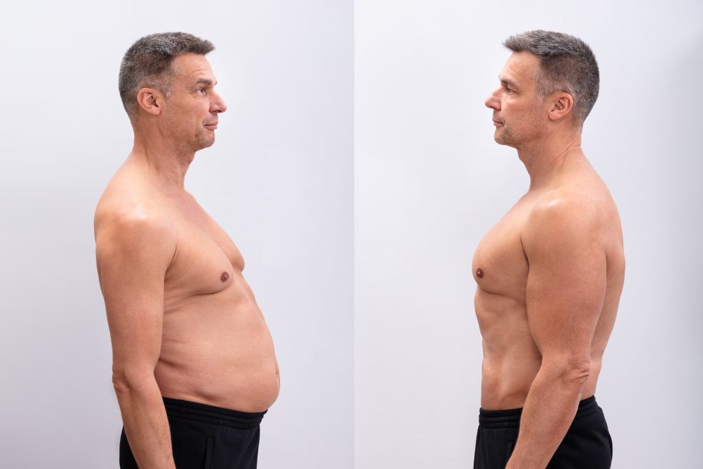homme gras se regardant après l'abdominoplastie